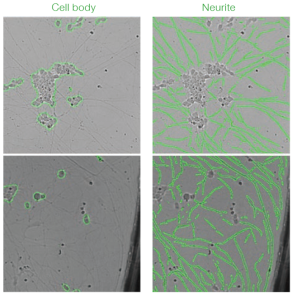 Cell3iMager duos を用いたiPS 細胞由来神経細胞の明視野解析