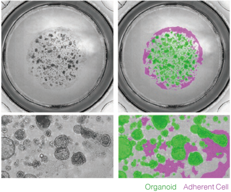 Label free imaging and analysis of organoids using Cell3iMager