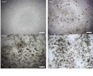 Disease modeling and imaging assays using human iPS cell-derived airway organoids